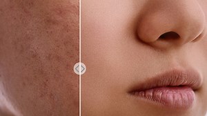 7.2K views · 145 reactions | Quickest Way to Smooth SKIN & Remove Blemishes#photoshop #tutorial #reels #SkinSmooth | Akkas Editing | Facebook
