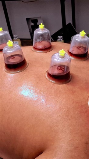 #HijamaTraining #LearnHijama #HijamaCourse #HijamaTherapy #HijamaPractitioner #WetCuppingTraining #CuppingTherapyCourse #SunnahCuppingTraining #HijamaLondon #LondonHijama #HijamaUK #UKHijamaTraining #CuppingLondon #LondonCourses #TrainingInLondon #SunnahHealing #IslamicHealing #SunnahPractitioner #HalalBusiness #MuslimEntrepreneur #MuslimBusinessUK #StartYourOwnBusiness #LearnNewSkills #EarnFromHome #OnlineCoursesUK #HolisticHealthTraining