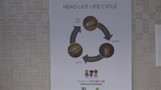 With school starting back up, here's the local protocol for when students get head lice