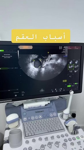 Understanding Fetal Ultrasound Imaging Process