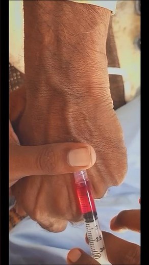 IV injection procedure| Intravenous injection procedure.