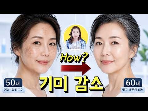기미 잡티 흑자 색소침착 해결 방법