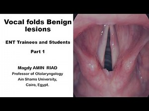 Vocal folds Benign lesions ENT Trainees and Students Part 1
