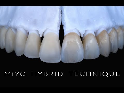 MiYO Hybrid Technique - Workflow with MiYO and InSync ZR veneering ceramic [ASMR]