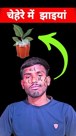 चेहरे की झाइयां (facial freckles)