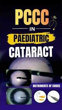 A crucial step in paediatric cataract surgery.