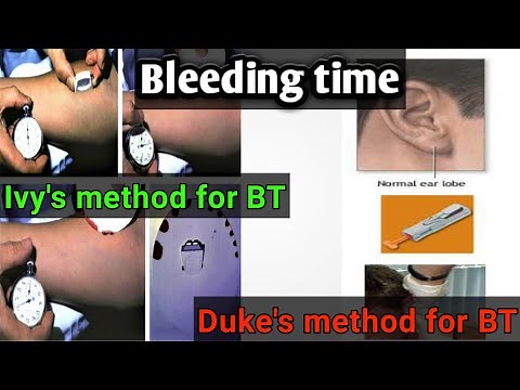 blood Bleeding time test: Duke's and Ivy’s method: blood coagulation profile lecture 2