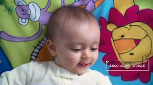 314K views · 42 reactions | Fluffy kittens chasing a ball are beyond adorable -- but they sure aren't born that way. Practically deaf and blind, in their first few weeks they need constant warmth and milk to survive. This is a huge challenge for animal shelters, so they're working with researchers on ways to help motherless kittens flourish. Via Deep Look • PBS. | Rewire | Facebook