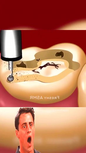 157K views · 1.2K reactions | DIY ASMR Makeup Animation #animation #asmr #cleaningtip #asmrmakeup #asmranimation #asmrvideo #animationvideo #makeover | ASMR Makeup | Facebook