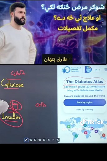 Diabetes Millites explained simply- Symptoms - Causes - Treatment - Tariq Pathan #tariqpathan #research