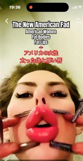 アメリカの女性！太った体と厚い唇 アメリカの最新トレンド？肥満とボトックス唇の末路. American Fads For Women. Fat Lips & Bodies