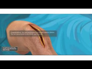 Quill Bi Directional Barbed Suture Animation - 3 Layer Tissue Closure after TKA (COR 265 R0)
