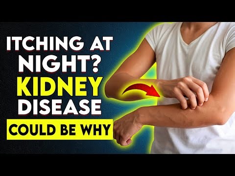 The Hidden Kidney Symptom No One Talks About (And How to Stop Itching!)