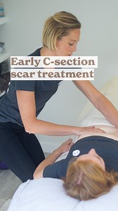 10K views · 60 reactions | C-section recovery⠀⠀⠀⠀⠀⠀⠀⠀⠀Ways to treat your c-section scar in the first postpartum weeks. Follow for more from postpartum professionals.⠀⠀⠀⠀⠀⠀⠀⠀⠀#csection #scarmassage #csectionscar #csectionmom | The 360 Mama | Facebook