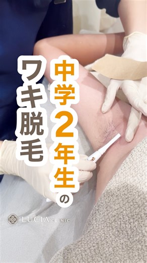 中学2年生脇脱毛デビュー👏🏼 ＿＿＿＿＿＿＿＿＿＿ ルシアクリニックでは 熱破壊式《ジェントルシリーズ》だけを使用。 効果のある永久脱毛をご提供しています💡 「理想の脱毛」ルシアクリニックで 叶えてみませんか？☺️🌸 無料カウンセリングは プロフィールURLまたは お電話からお気軽にどうぞ🕊️ ＿＿＿＿＿＿＿＿＿＿ #ルシアクリニック #医療脱毛 #医療脱毛クリニック #熱破壊式 #脇脱毛 #中学生脱毛 #脇 #脱毛照射 #脱毛レポ | ルシアクリニック【LUCIA CLINIC】