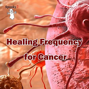 🎧 Healing Frequency for Cancer – Spooky2 Rife Frequency Healing Cancerous cells can form tumors, impair the immune system, and cause other changes that prevent the body from functioning regularly. Cancerous cells may appear in one area, then spread via the lymph nodes. This frequency audio will help you: ✅ Relieve certain types of pain in people with cancer. ✅ Relieve nausea and stress. ✅ Improve human immunity. ✅ Reduce the side effects of cancer treatment. Welcome to listen to this frequency 