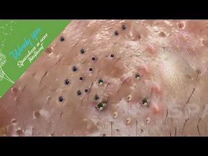 Make Your Day Relaxing with Windy Spa 6#86