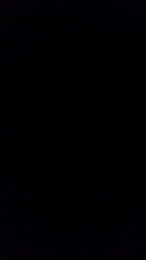 พอใจ กับ #จมูกแรก มากกก สมกับราคา และการเจ็บตัว #ถูกใจใช่เลย #ศัลยกรรมเกาหลี ❤️🇹🇭🇰🇷