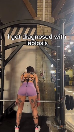 Rileyy on Instagram: "I never thought I’d talk about this publicly. But I think it’s time. Because if my story helps even one person out there with labiosis… then it’s worth it. It started when I was younger. I didn’t even know what labiosis meant just that people treated me differently. The stares, the giggles, the rumors that I didn’t understand yet. It wasn’t something I could hide, and somehow that made it worse. Growing up with labiosis wasn’t easy. I’d get ready for dates and overthink eve