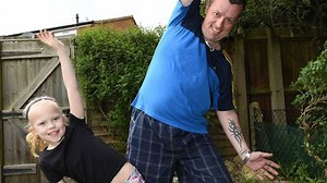 'Bionic Dad' has TWO hip-ops aged just 41 to cure crippling arthritis