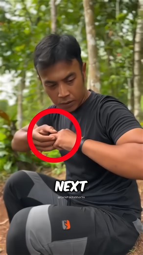 Deadly Snake Bite 😳