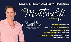 Mini Face Lift - Palm Springs | Rancho Mirage | La Quinta
