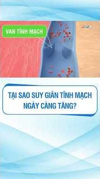 Tại sao suy giãn tĩnh mạch ngày càng tăng? #suygiantinhmach #shots #tintuc