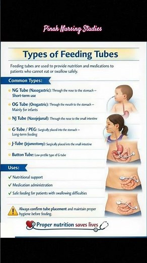Types of Feeding Tube