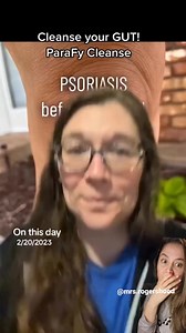 17K views · 151 reactions | PARASITES & SKIN CONDITIONS: VERY LINKED...