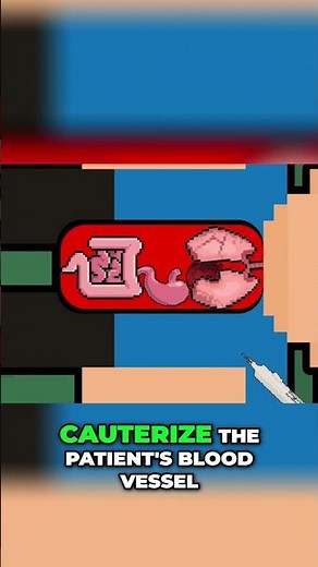 Surgery Nightmare: The Explosion That Shocked Doctors!