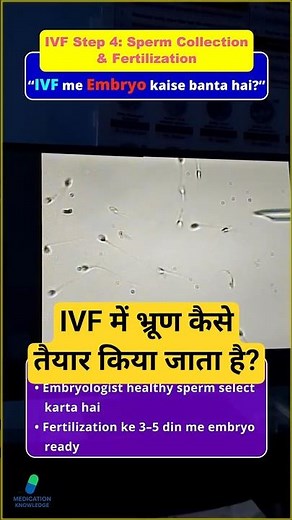 IVF Step 4 Explained | Sperm Collection & Fertilization Process #drrakshitamalik #ivf #ivfawareness