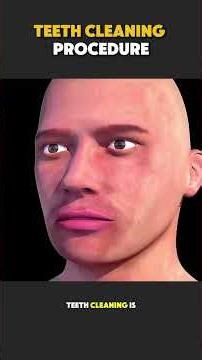 Teeth Cleaning Procedure (3D Animation). #teethwhitening