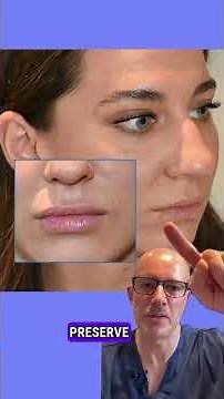 Achieving Perfect Lips: The 8D Lip Design Technique Explained | Safe & Natural Lip Filler