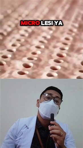 how MICRO NEEDLING works⁉️😰 #healthfacts #uniquefacts #drbimo