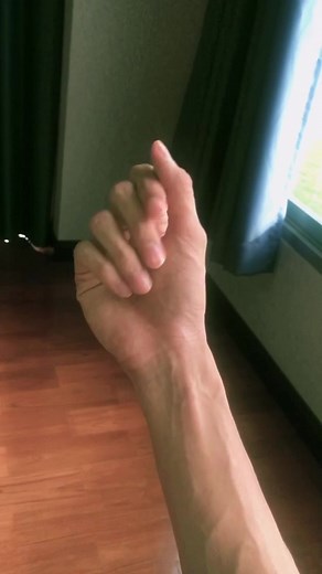 Vein Check Challenge: Asian Hands Edition