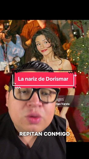 Todas las cirugías conllevan un riesgo… hablemos de la nariz de Dorismar #dorismar #cirugiaplastica #rinoplastia