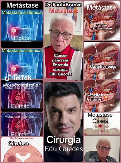 Entenda a cirurgia de câncer com Dr. Paulo Branco