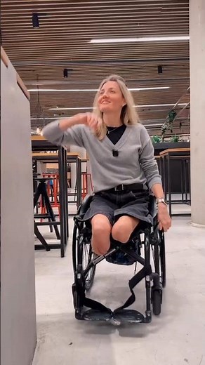 Brave Girl Walking with Artificial Legs | Above & Below Knee Prosthetic Journey #prosthetics