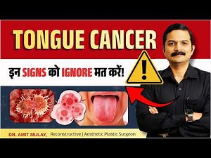Tongue Cancer Treatment Explained: Surgery, Reconstruction & Recovery | Dr. Amit Mulay