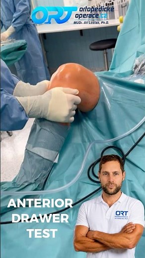 🚨 Positive Anterior Drawer Test – ACL Tear?