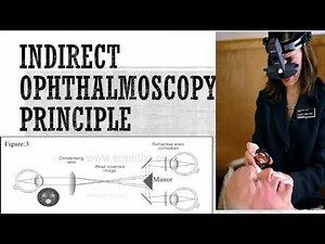 PRINCIPLE OF INDIRECT OPHTHALMOSCOPY Part - 1