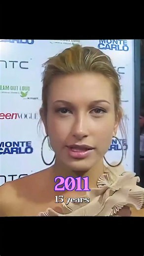 Vitória Tomaz • Dermatologia Tricologia Itaim Bibi e Campinas on Instagram: "O envelhecimento da Hailey Bieber, do ponto de vista dermatológico, é um ótimo exemplo de estratégia precoce e consistente, aquela que quase passa despercebida justamente porque funciona. Hailey sempre teve uma pele jovem, com boa elasticidade e distribuição harmônica de volume facial. O que chama atenção ao longo do tempo não é uma transformação brusca, mas a manutenção da qualidade da pele. Textura uniforme, viço, por