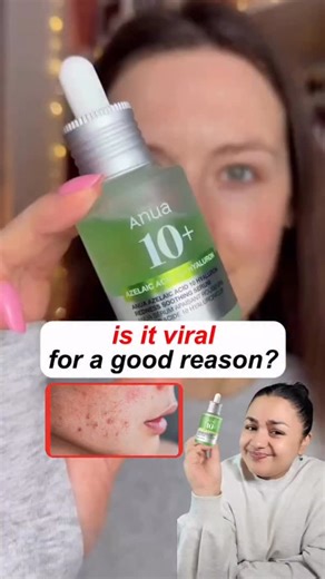 Richa Deb on Instagram: "#unsponsored Video 🫰 These are things you need to know before buying this viral green @anua_global acid serum if are Struggling with acne marks, redness & dehydration✨ I purchased it from @glam_orchid_makeup.store [anua azelaic acid serum, anua azelaic serum review, azelaic acid serum, azelaic acid for acne, azelaic acid for pigmentation, azelaic acid for dark spots, azelaic acid for redness, azelaic acid for sensitive skin, , korean azelaic acid serum, k beauty azelaic