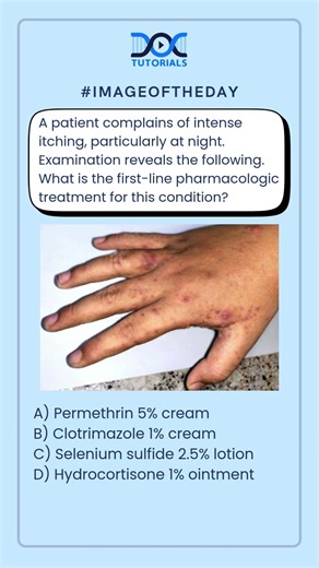 Intense Itching at Night: What is the first-line pharmacologic treatment for this condition?