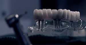 Lawsuits filed against Arizona nurse anesthetist after two dental deaths, fire in mouth