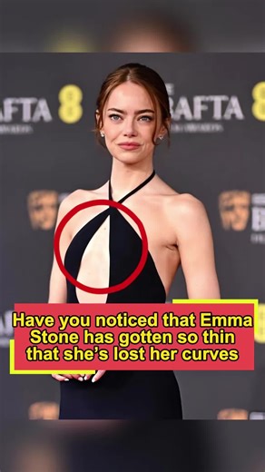 Emma Stone's Transformation: The Slimming Journey