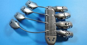Engineers Create A Titanium Rib Cage Worthy Of Wolverine