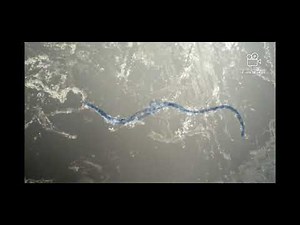 COVID-19 Vax Microscopic Observations