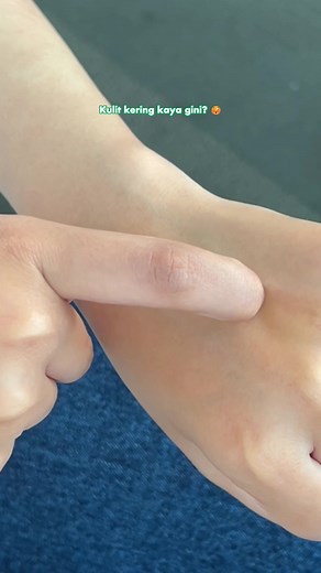 Solusi Kulit Kering dengan Natur-E Skin Start HBL