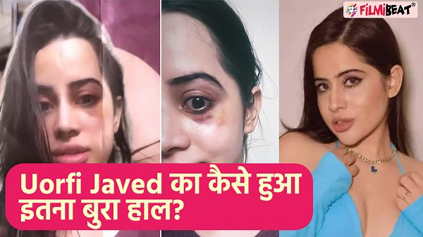 Urfi Javed recently got under eye fillers done, after which her eyes became very bad and her face became swollen. Urfi Javed showed his condition by posting a post on social media. Also shared a video, in which she is telling that all under eye creams are scam. Watch Out #UorfiJaved #UrfiInstaStory #UrfiLatestNews | Filmibeat.com
